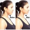 Neckline Chin Massager – Double Chin Reducer & Jawline Slimmer