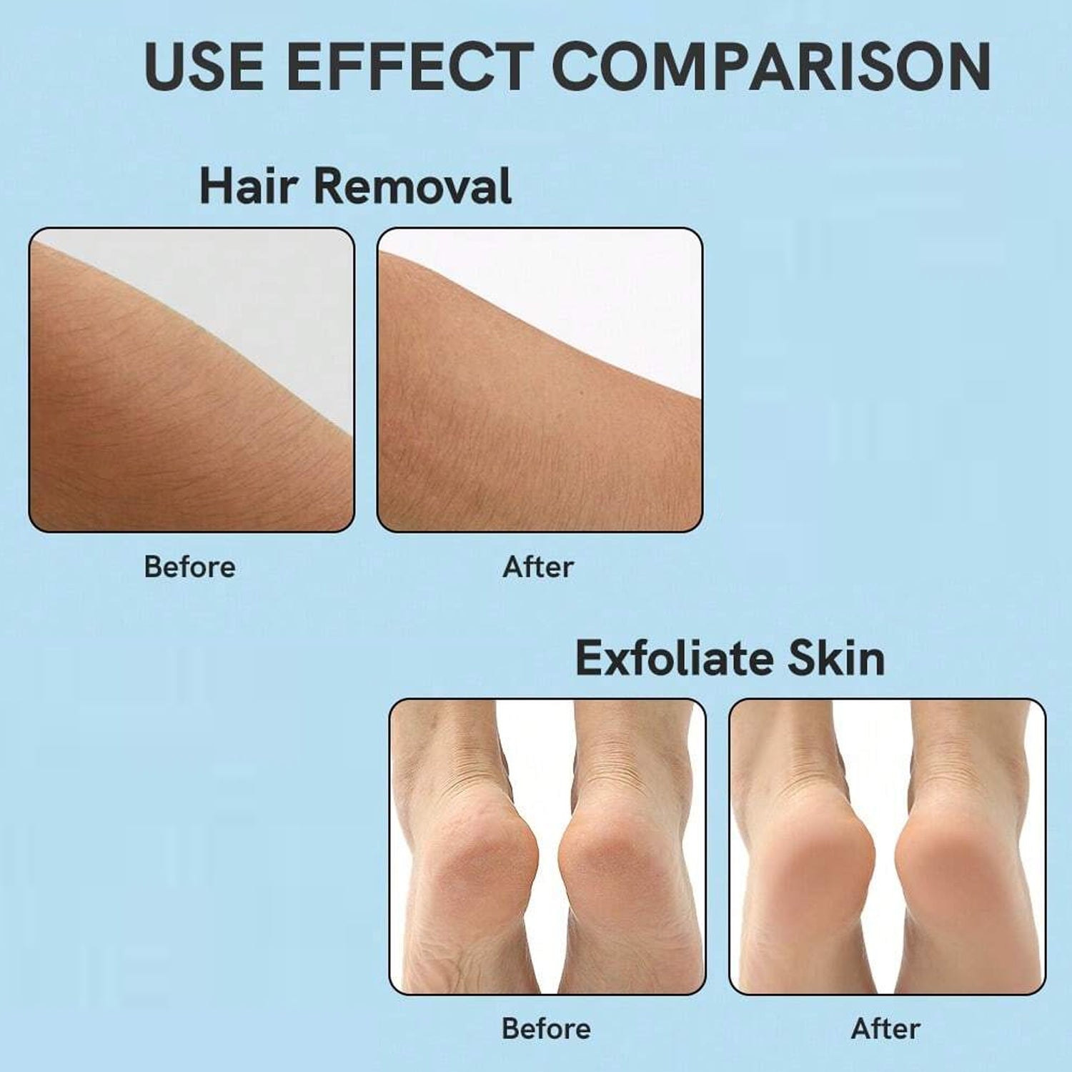 Nano Hair Remover for Arms, Legs, Back One Sided Skin Hair Remover (1 Pc) - Shivani Jaswal Nano Hair Remover for Arms, Legs, Back One Sided Skin Hair Remover (1 Pc)