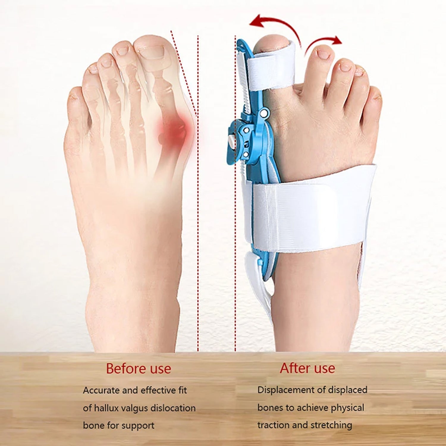 Adjustable Bunion Support Splint – Hallux Valgus Corrector for Men & Women - Shivani Jaswal Adjustable Bunion Support Splint – Hallux Valgus Corrector for Men & Women