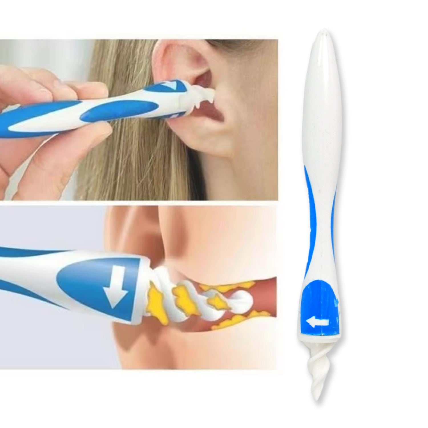Ear Wax Removal Ear Cleaner Earwax Remover Spiral Soft Silicone Safe Upgraded Smart Earwax Removal Tool Swab Kit With 16 Replacement Tips For Adults & Kids - Shivani Jaswal Ear Wax Removal Ear Cleaner Earwax Remover Spiral Soft Silicone Safe Upgraded Smart Earwax Removal Tool Swab Kit With 16 Replacement Tips For Adults & Kids