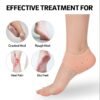 Anti Crack Silicon Gel Heel Moisturizing Socks for Foot Care Men Women (Loose Pack)